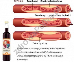 Polifenum Forte cholesterol, krzepliwość, serce