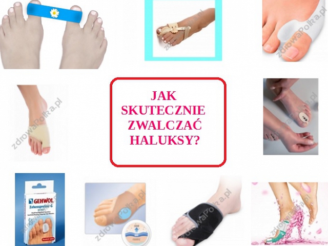 Jak walczyć z haluksami?